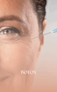 HARMONIZAÇÃO FACIAL (3)