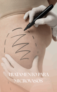 HARMONIZAÇÃO FACIAL (6)